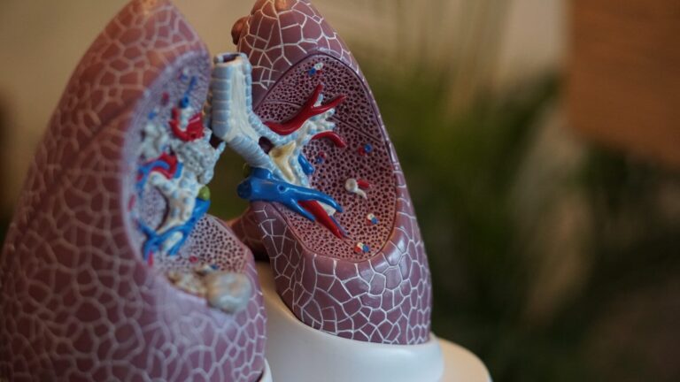 The Biggest Opportunity to Improve Lung Cancer Survival Isn’t a New Drug